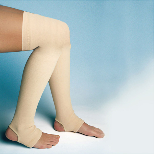 progressive-thigh-varices-stockings-image